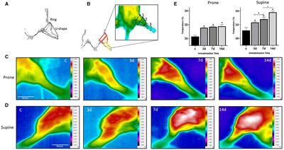 Infrared thermography and computed tomography imaging for hind limb study after immobilization-induced disuse atrophy